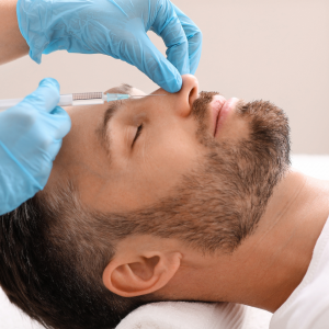 Non-Surgical Rhinoplasty Filler