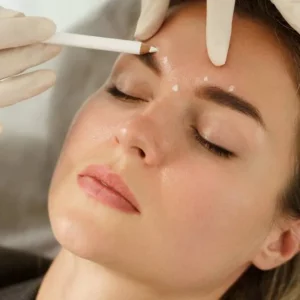 4 Areas Anti-wrinkle Treatment