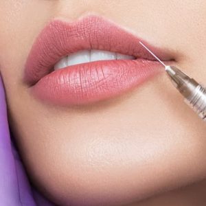Lip Fillers 1.1 ml